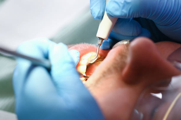 Best Walk-In Emergency Dentist in Glenview, IL